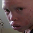 africas-albinos-blog avatar