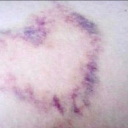 allmyfriendsareworms avatar