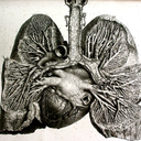 bilateralpleurodesis avatar