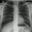 cigarettediaries avatar