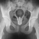 cironblossom-blog avatar