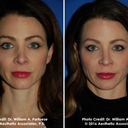 coloramiditesblog avatar