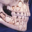 computertooth avatar