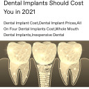 dental-implants-should-cost avatar