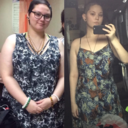 gastricsleevesandgallstones avatar