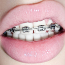 girlswithbracespreview-blog avatar