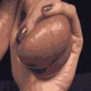 herstrokevictim avatar