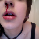 iheartnosebleeds-blog avatar