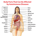 lifewithautoimmune avatar