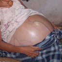 painfullydistended avatar