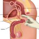 prostatetherapies avatar