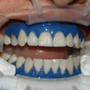 pseudologia-phantastica avatar