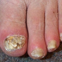 scratch-and-sniff-toenails avatar