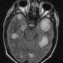 shitstain-brain avatar