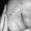 soy-mas-que-acne avatar