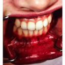 unefiguemolle avatar